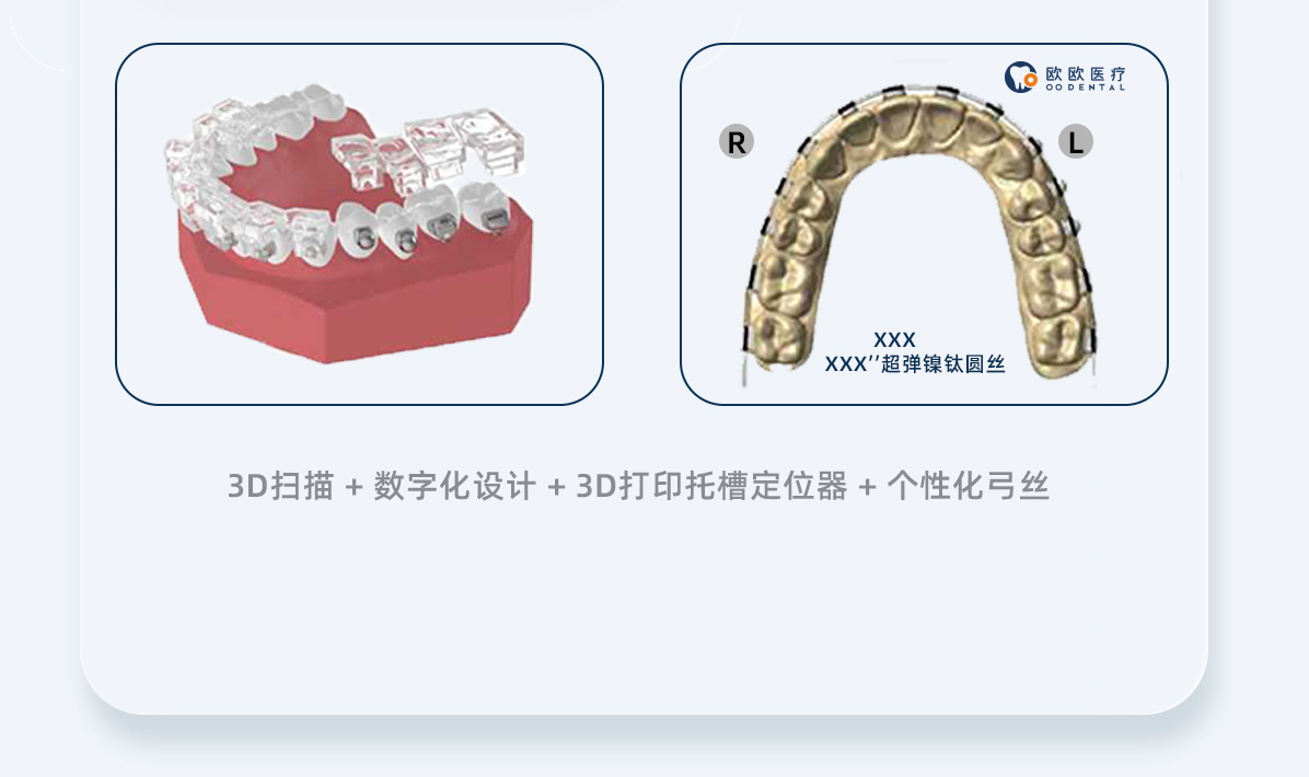 OBRACE5S数字化版_05.jpg